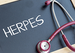 Online Genital Herpes Treatment