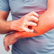 man scratching arm due to scabies exposure