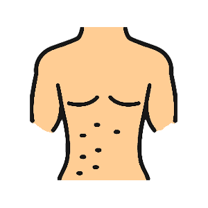 Get treatment for skin conditions. Drawing of torso with rash
